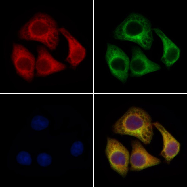 NAT1 Antibody in Immunocytochemistry (ICC/IF)