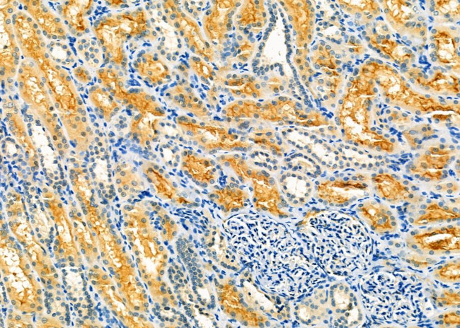 NAT1 Antibody in Immunohistochemistry (Paraffin) (IHC (P))