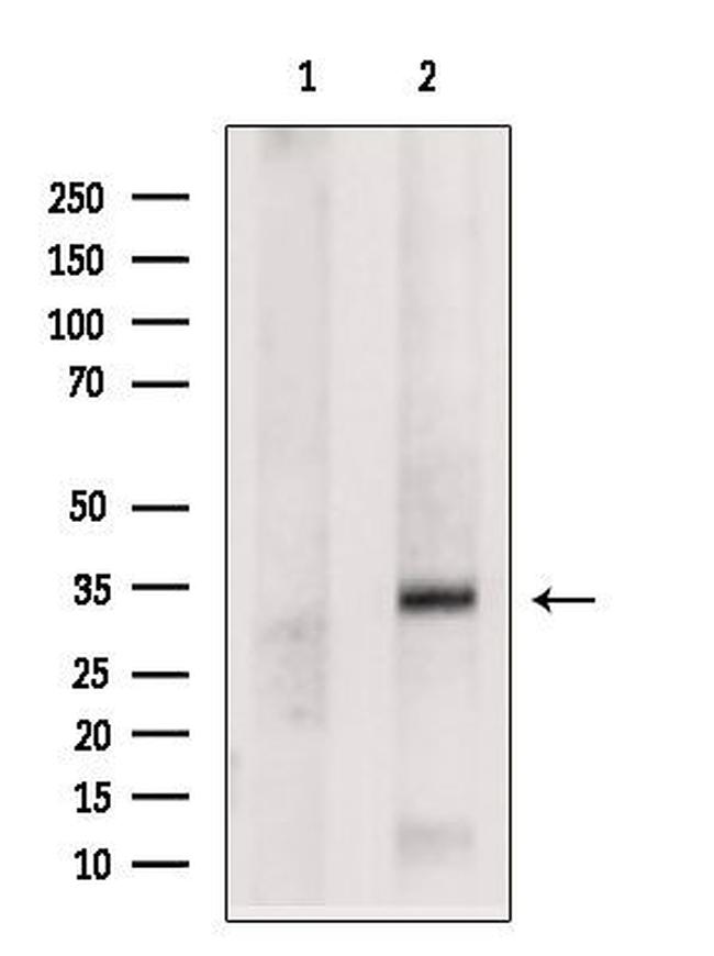 NAT1 Antibody in Western Blot (WB)