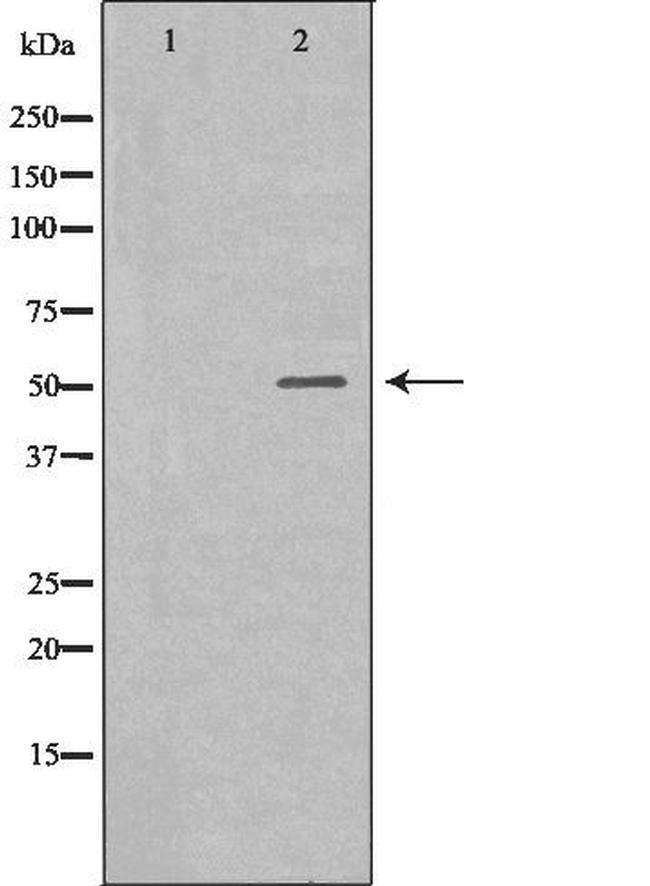 IL-6R Antibody in Western Blot (WB)