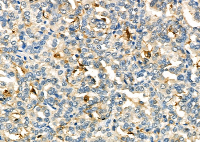 IL-6R Antibody in Immunohistochemistry (Paraffin) (IHC (P))