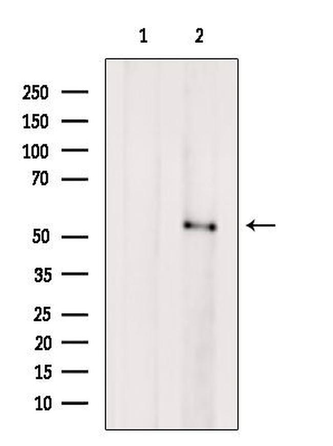 SERPINC1 Antibody in Western Blot (WB)