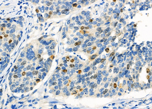 KPNA2 Antibody in Immunohistochemistry (Paraffin) (IHC (P))