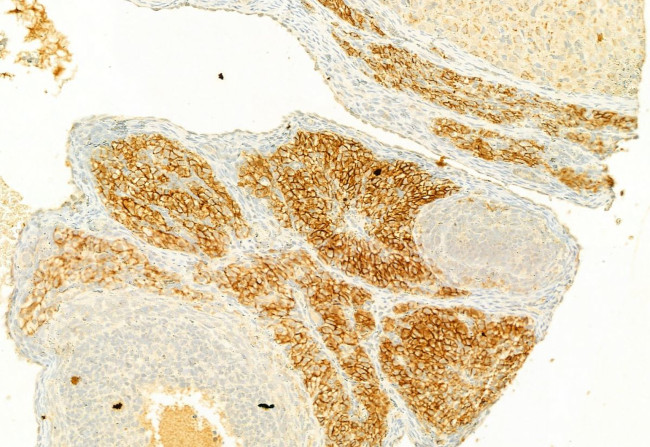 S100A4 Antibody in Immunohistochemistry (Paraffin) (IHC (P))