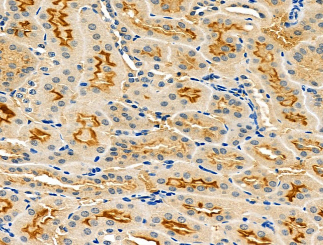 LOX-1 Antibody in Immunohistochemistry (Paraffin) (IHC (P))