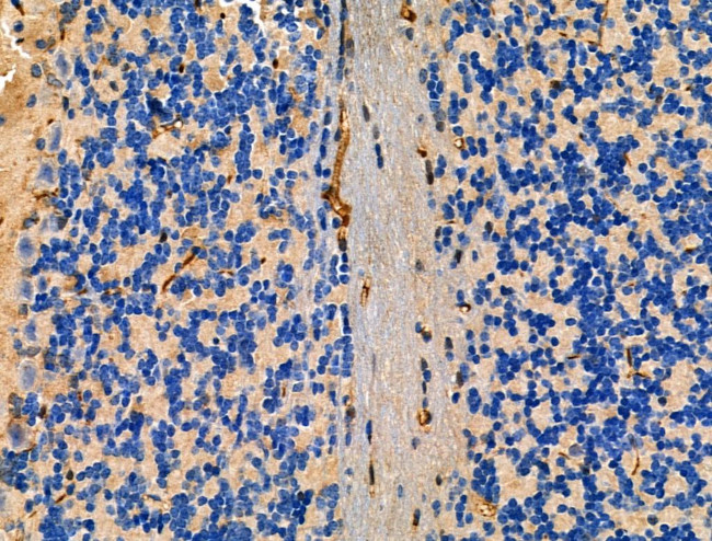 LOX-1 Antibody in Immunohistochemistry (Paraffin) (IHC (P))