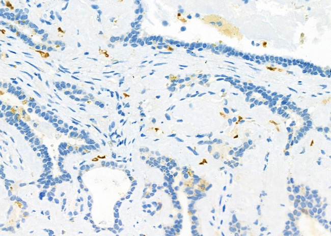 CD162 Antibody in Immunohistochemistry (Paraffin) (IHC (P))