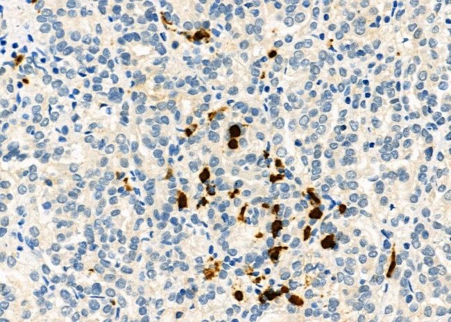 CD162 Antibody in Immunohistochemistry (Paraffin) (IHC (P))