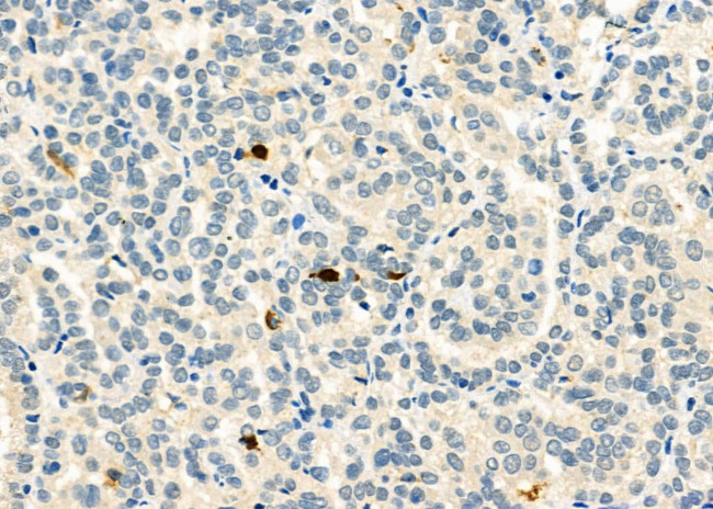 CD162 Antibody in Immunohistochemistry (Paraffin) (IHC (P))