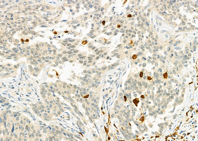 CD162 Antibody in Immunohistochemistry (Paraffin) (IHC (P))