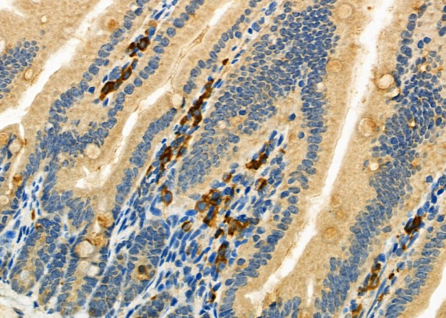 CD162 Antibody in Immunohistochemistry (Paraffin) (IHC (P))