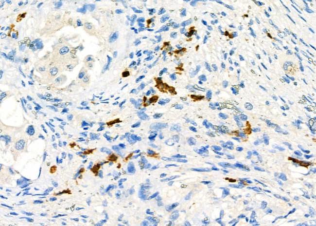 CD162 Antibody in Immunohistochemistry (Paraffin) (IHC (P))