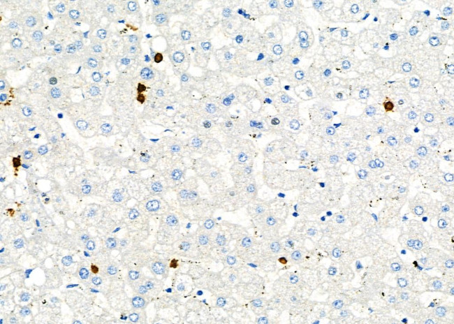 CD162 Antibody in Immunohistochemistry (Paraffin) (IHC (P))