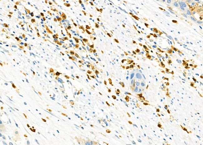 CD162 Antibody in Immunohistochemistry (Paraffin) (IHC (P))