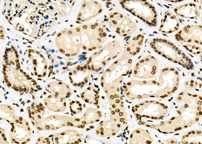 POLI Antibody in Immunohistochemistry (Paraffin) (IHC (P))