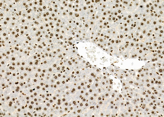 POLI Antibody in Immunohistochemistry (Paraffin) (IHC (P))