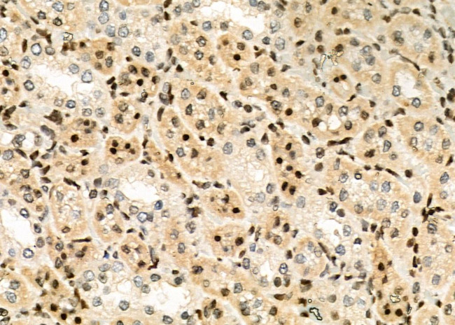 POLI Antibody in Immunohistochemistry (Paraffin) (IHC (P))