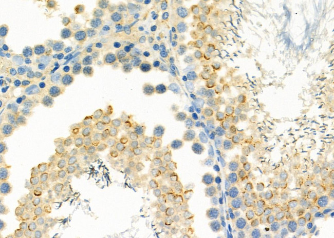 MB67 Antibody in Immunohistochemistry (Paraffin) (IHC (P))