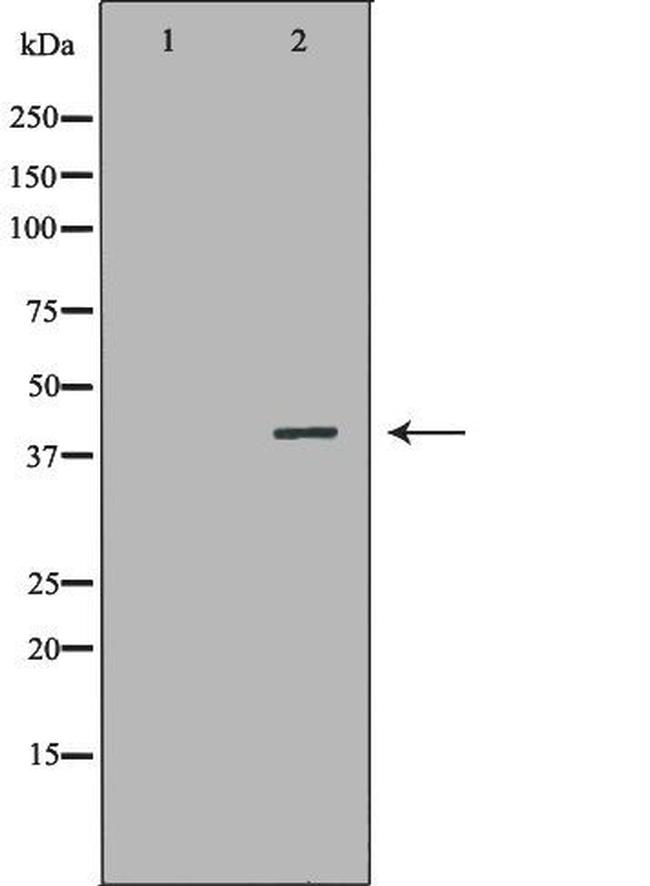 MB67 Antibody in Western Blot (WB)