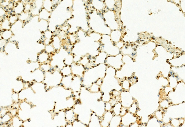 MT2A Antibody in Immunohistochemistry (Paraffin) (IHC (P))