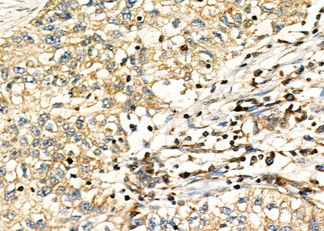 CD33 Antibody in Immunohistochemistry (Paraffin) (IHC (P))