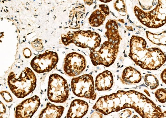 CD33 Antibody in Immunohistochemistry (Paraffin) (IHC (P))