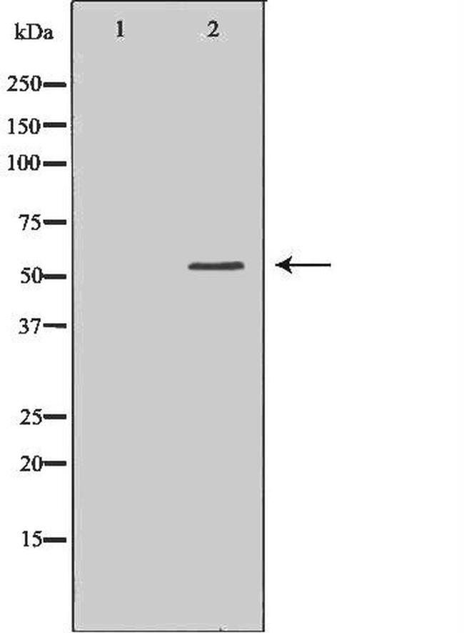 HCK Antibody in Western Blot (WB)