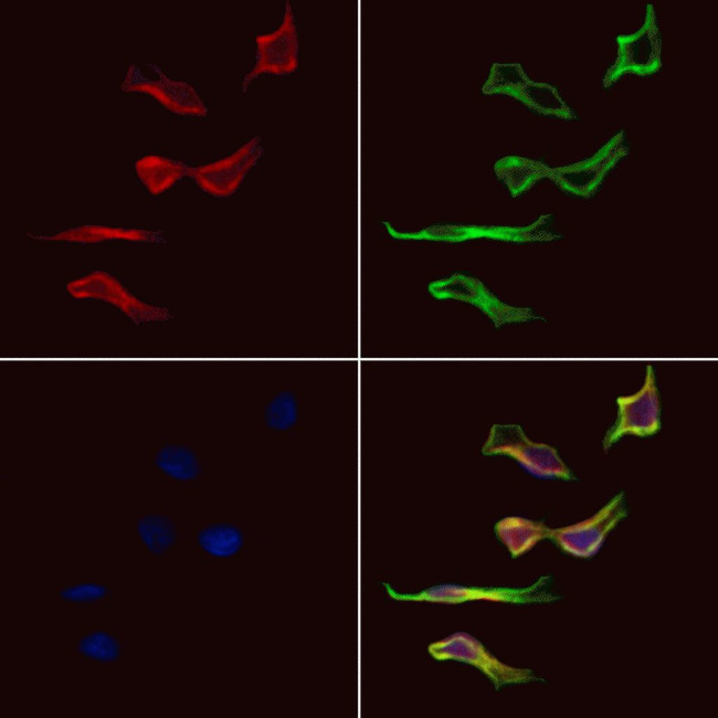 KBTBD3 Antibody in Immunocytochemistry (ICC/IF)