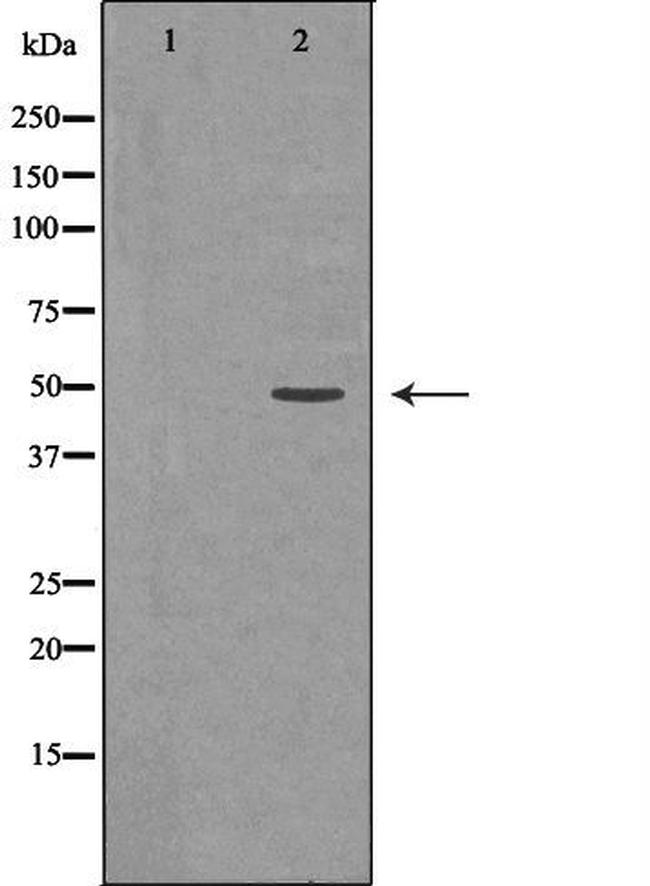 MKK7 Antibody in Western Blot (WB)