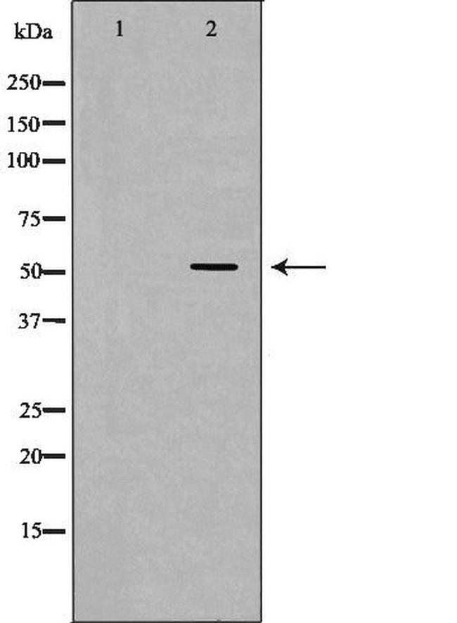 N-WASP Antibody in Western Blot (WB)