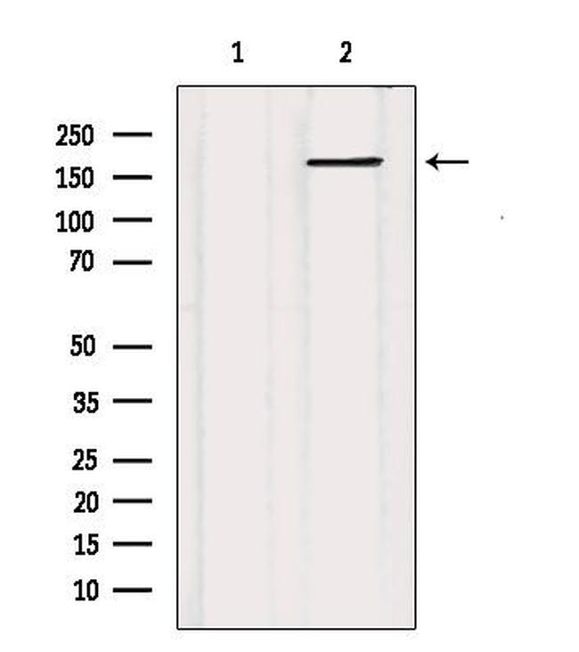 MRP5 Antibody in Western Blot (WB)