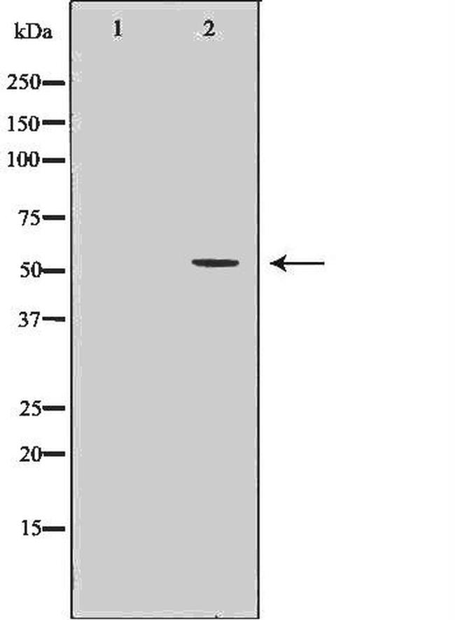 IMPDH2 Antibody in Western Blot (WB)