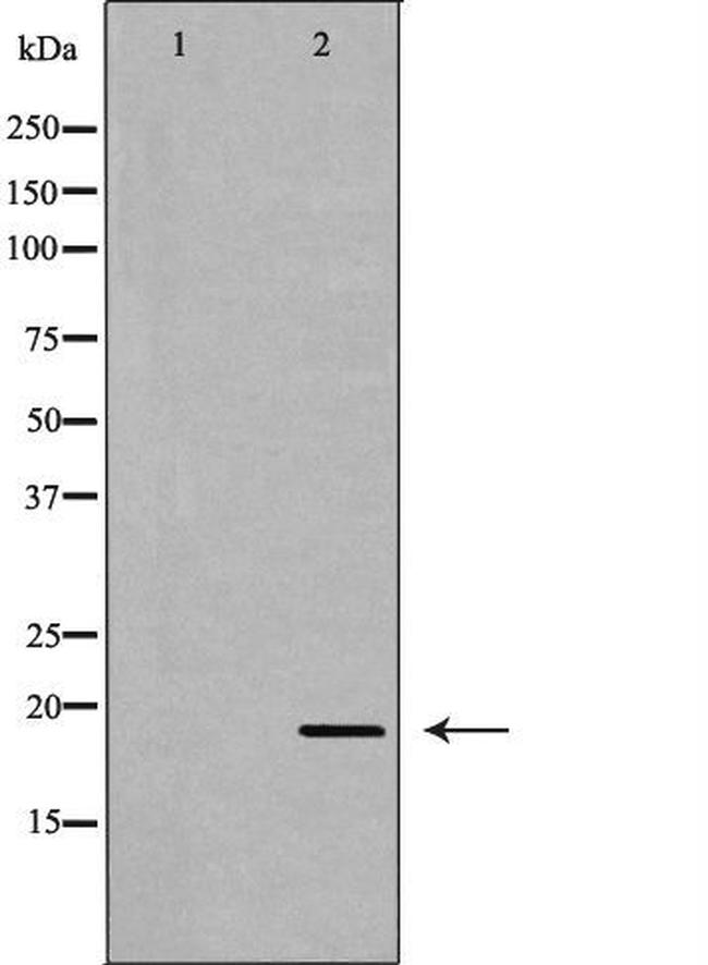 APRT Antibody in Western Blot (WB)