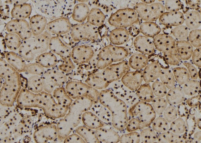 CRYBB2 Antibody in Immunohistochemistry (Paraffin) (IHC (P))