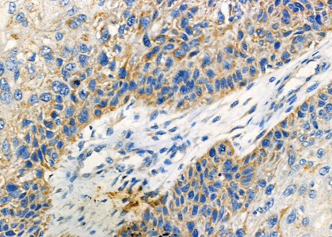 CRYBB2 Antibody in Immunohistochemistry (Paraffin) (IHC (P))