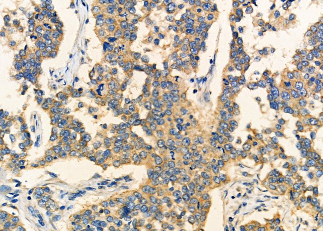 CRYBB2 Antibody in Immunohistochemistry (Paraffin) (IHC (P))