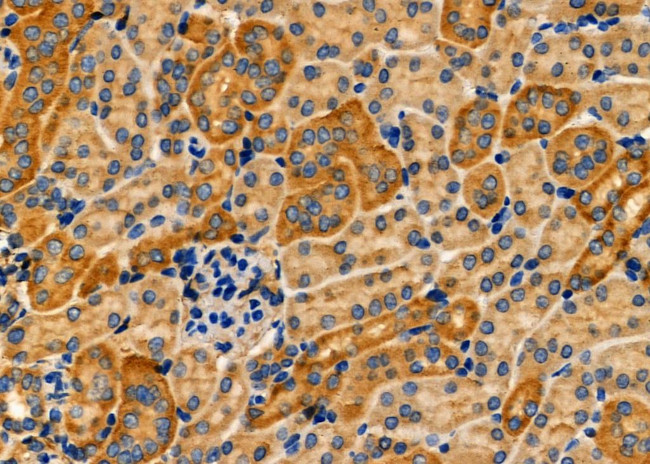 CRYBB2 Antibody in Immunohistochemistry (Paraffin) (IHC (P))