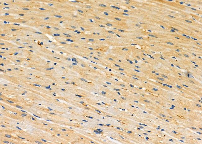 CRYBB2 Antibody in Immunohistochemistry (Paraffin) (IHC (P))