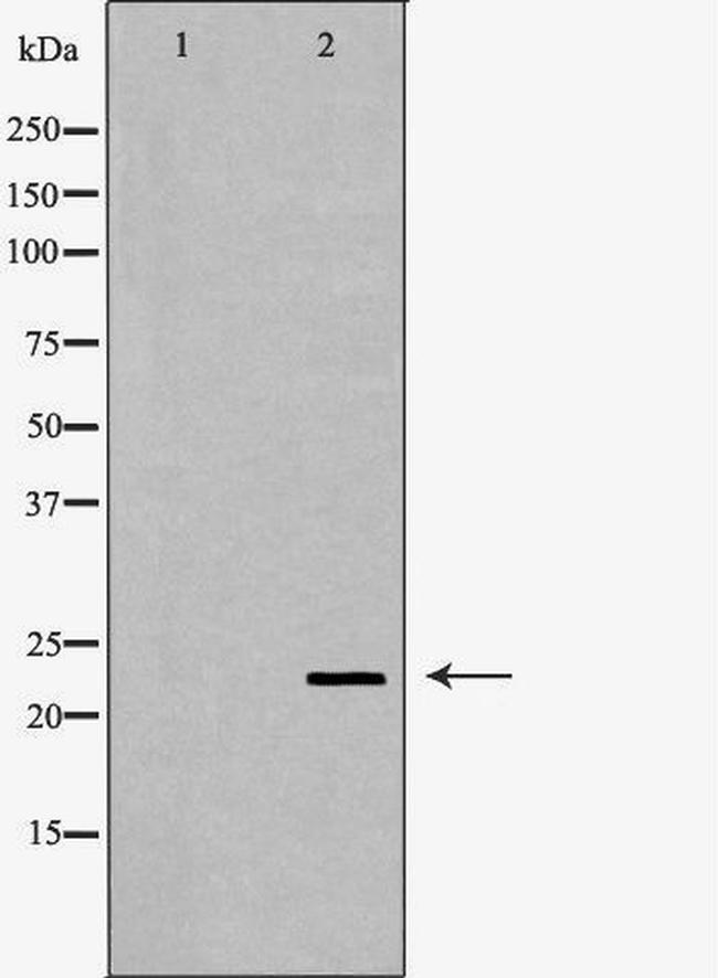 CRYBB2 Antibody in Western Blot (WB)