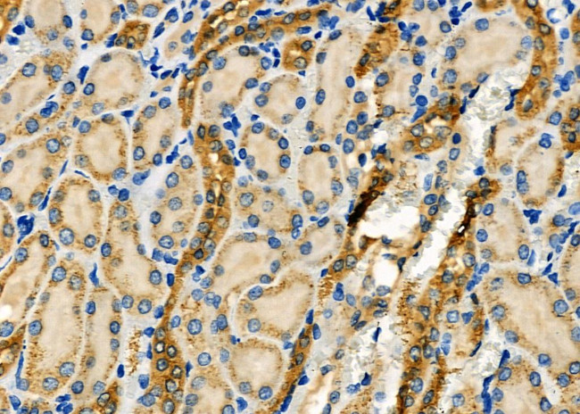 WNK3 Antibody in Immunohistochemistry (Paraffin) (IHC (P))