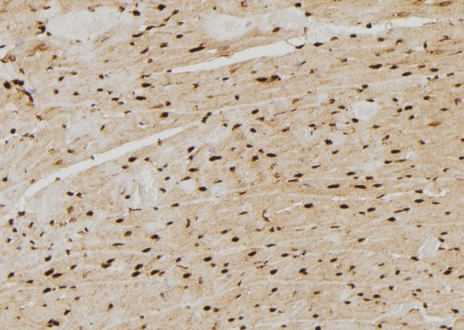 PSMB4 Antibody in Immunohistochemistry (Paraffin) (IHC (P))