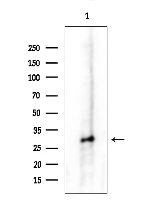 PSMB4 Antibody in Western Blot (WB)