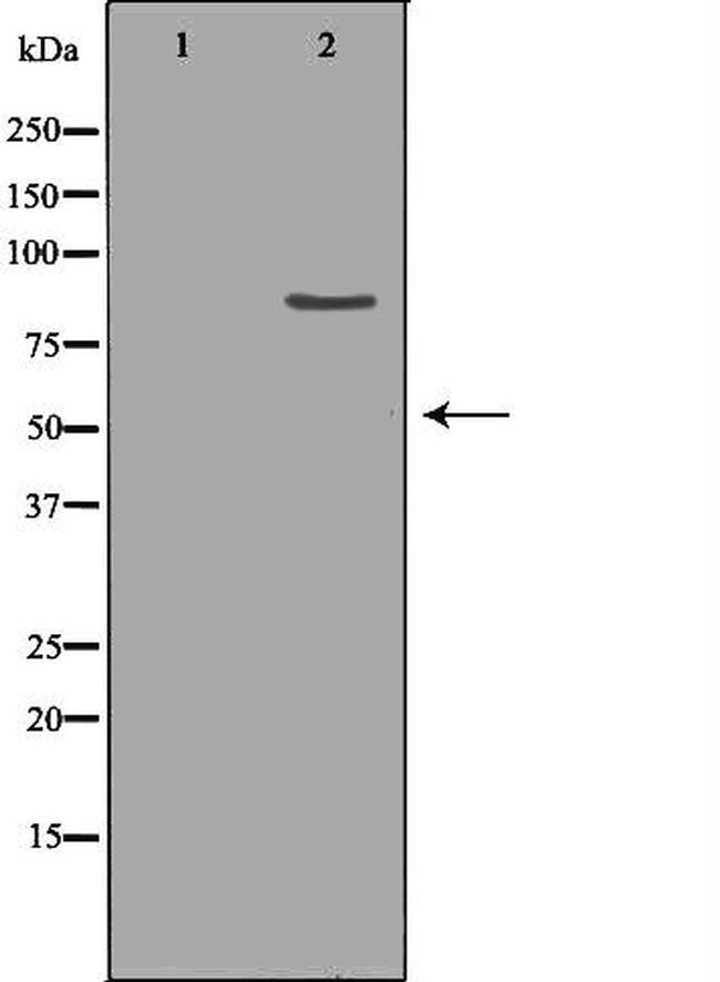 CLC-5 Antibody in Western Blot (WB)