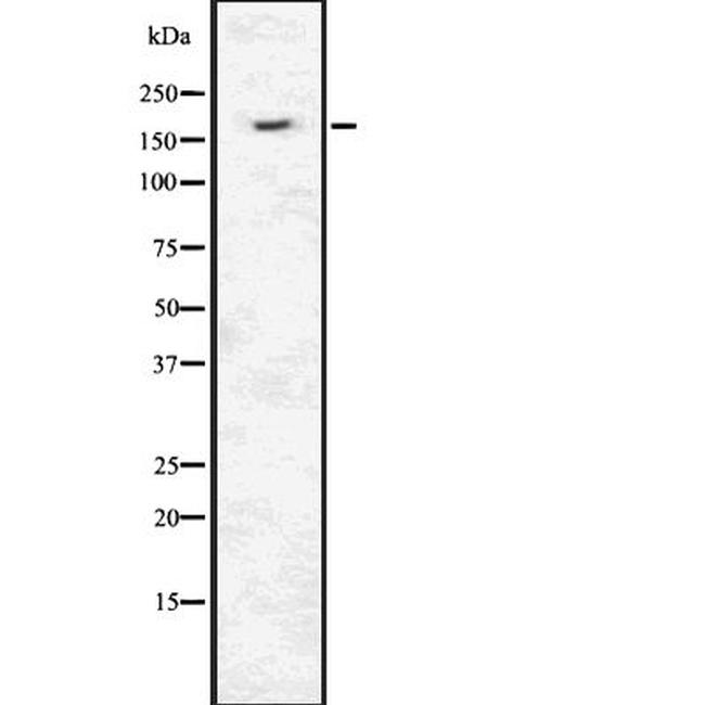 INSRR Antibody in Western Blot (WB)