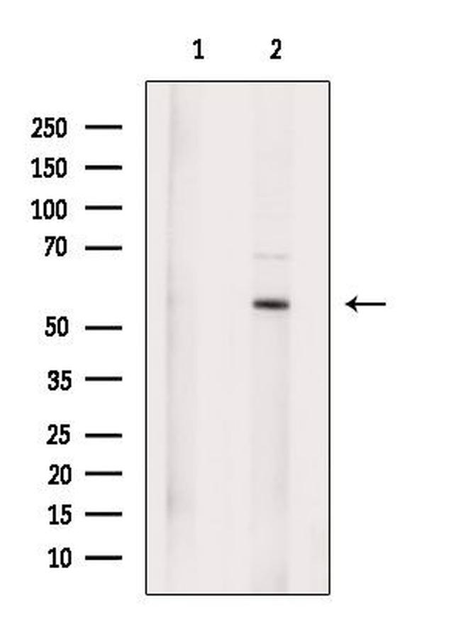 SUFU Antibody in Western Blot (WB)