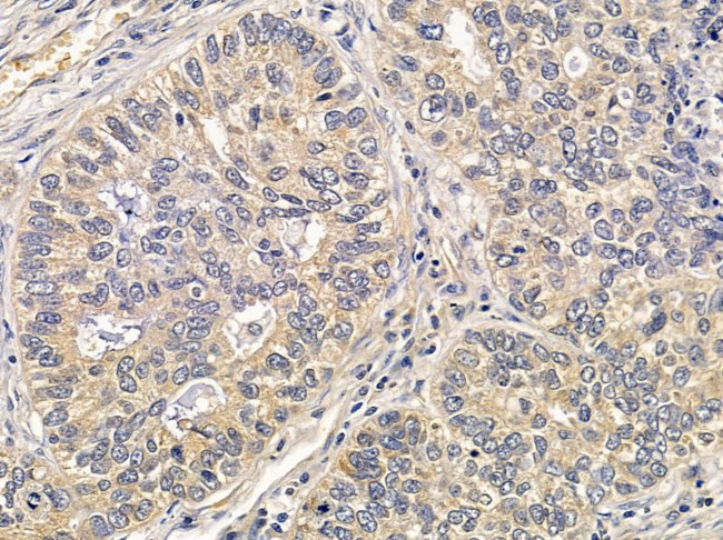 Importin 9 Antibody in Immunohistochemistry (Paraffin) (IHC (P))