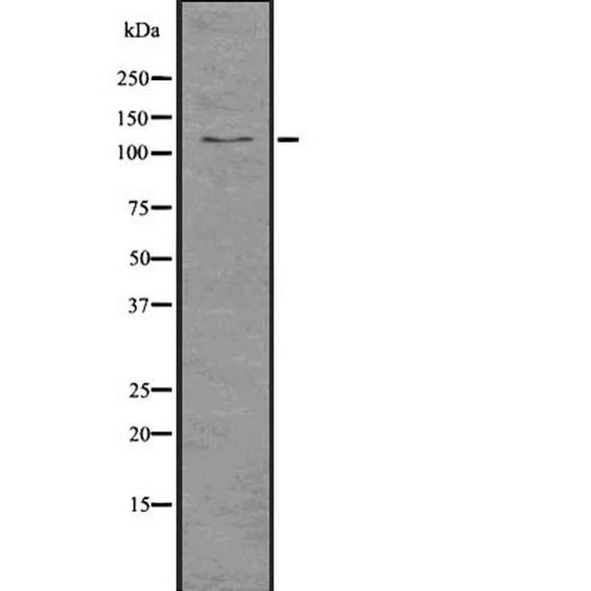 Importin 9 Antibody in Western Blot (WB)