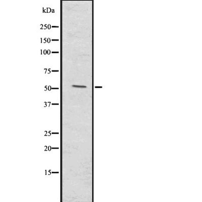 MMP20 Antibody in Western Blot (WB)