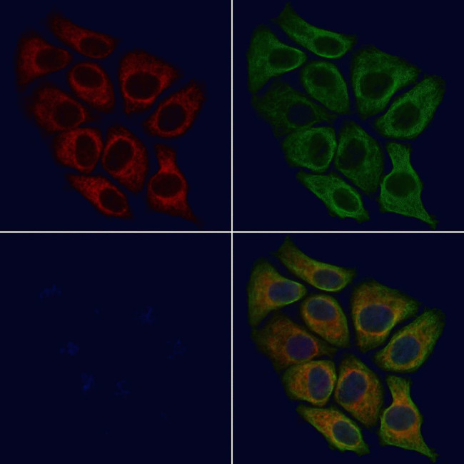 PPT1 Antibody in Immunocytochemistry (ICC/IF)