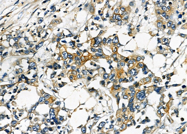 PPT1 Antibody in Immunohistochemistry (Paraffin) (IHC (P))